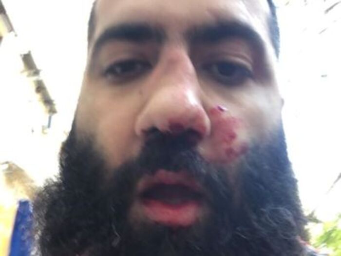 Physical clash between Armenian Parliament Vice-speaker and leader of far-right political party