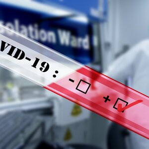 Covid-19 update in South Caucasus: growing concerns over the delta strain